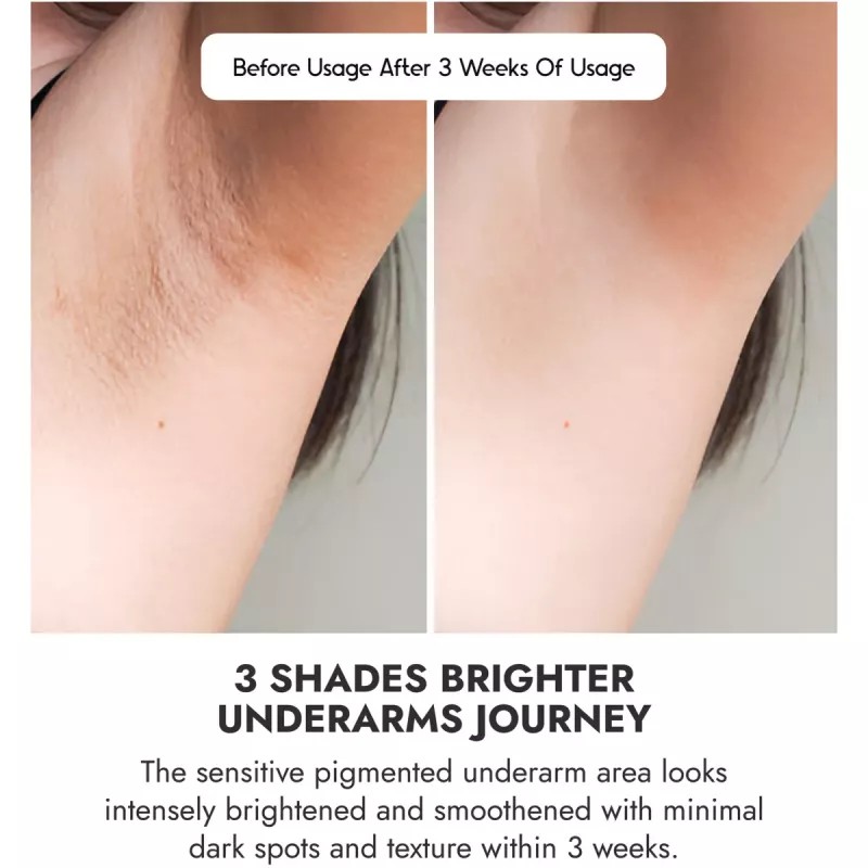 COSIQ Roll On Serum Underarm For Women (40ml)