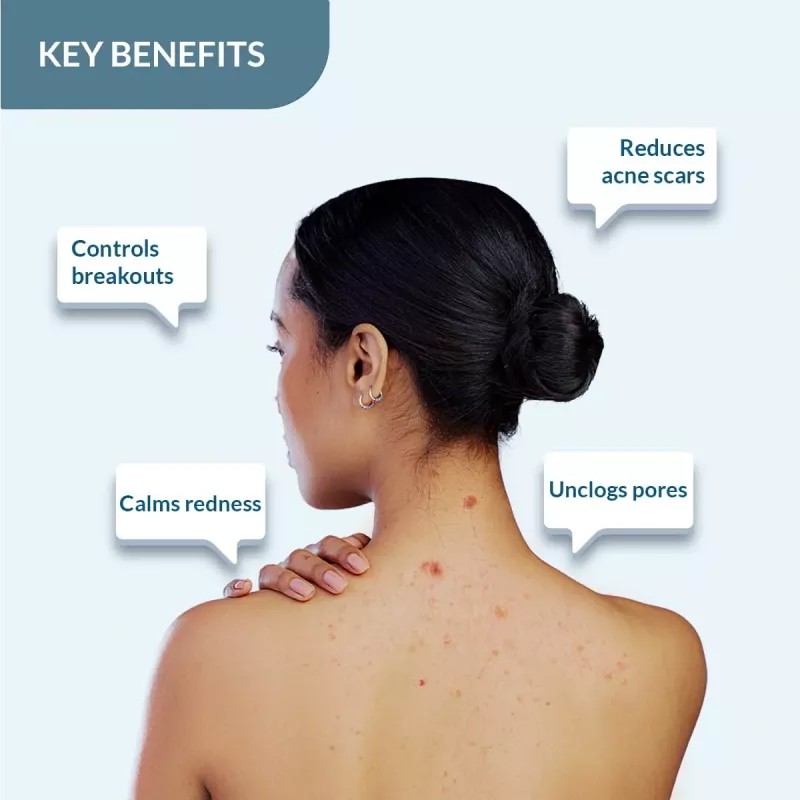 Fixderma Salyzap For Body Acne Body Wash (200ml)