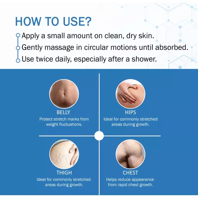 7Days Natural Stretch Mark Oil (100ml)