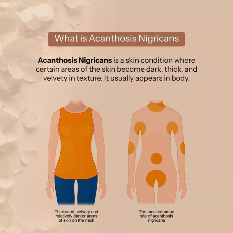 Glopetra Skin Tone Perfecting Cream (100ml)