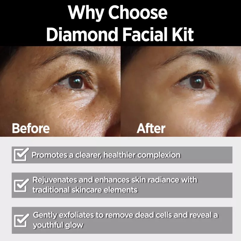 Multani Naturals Diamond Facial Kit For Diamond Glow (Cleansing Cream 20ml + Massage Cream 20ml + Face Scrub 20ml + Face Pack 20ml + Massage Gel 20ml) (100g)