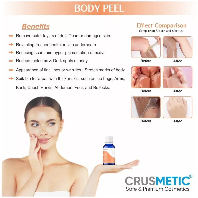 Crusmetic Body Peel + Neutralizer Solution + Brush+ Disifected Cotton Swab Stick (10ml + 30ml + 1 brush + 2 pcs Stick) (1Pack)