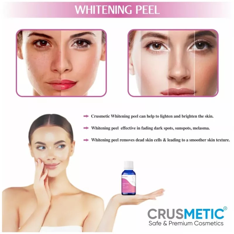 Crusmetic Whitening Peel + Neutralizer Solution + Brush+ Disifected Cotton Swab Stick (10ml + 30ml + 1 brush + 2 pcs Stick) (1Pack)