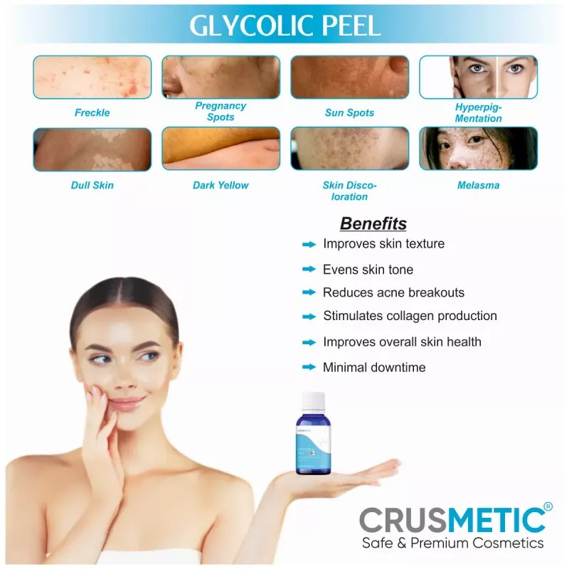 Crusmetic Glycolic 35% Peel + Neutralizer Solution + Brush+ Disifected Cotton Swab Stick (10ml + 30ml + 1 brush + 2 pcs Stick) (1Pack)