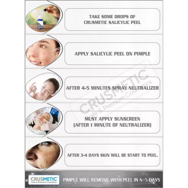 Crusmetic Salicylic Peel 15% + Neutralizer Solution + Brush+ Disifected Cotton Swab Stick (10ml + 30ml + 1 brush + 2 pcs Stick) (1Pack)