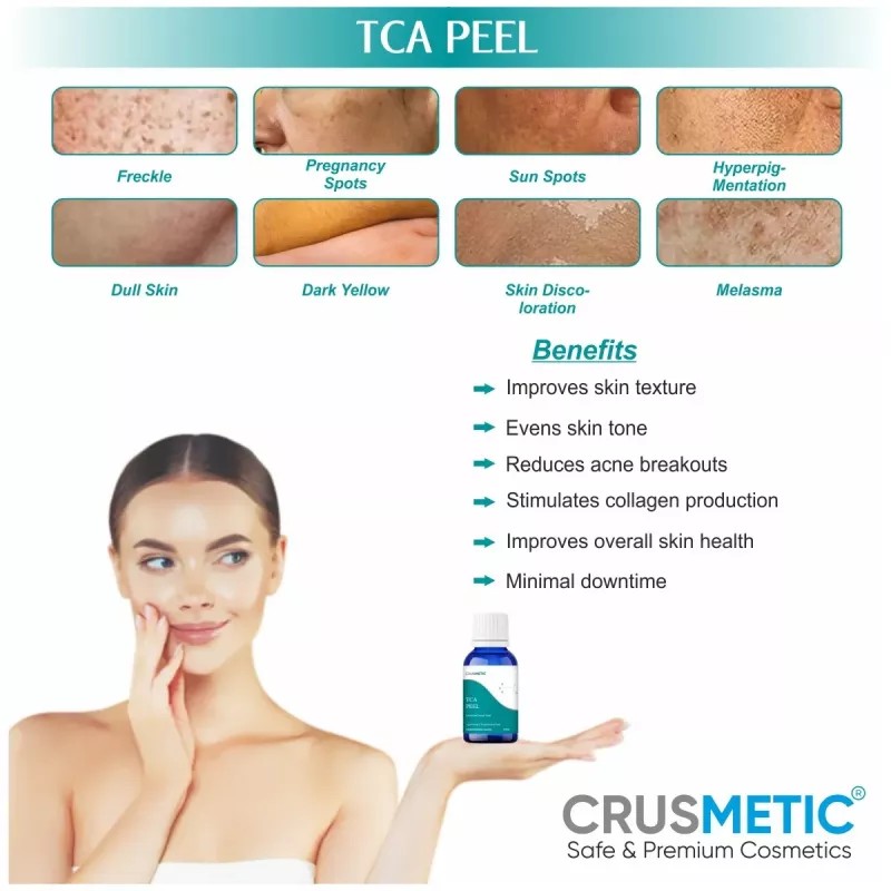 Crusmetic TCA 35% Peel + Neutralizer Solution + Brush+ Sterilized Cotton Swab Stick (10ml + 30ml + 1 brush + 2 pcs Stick) (1Pack)