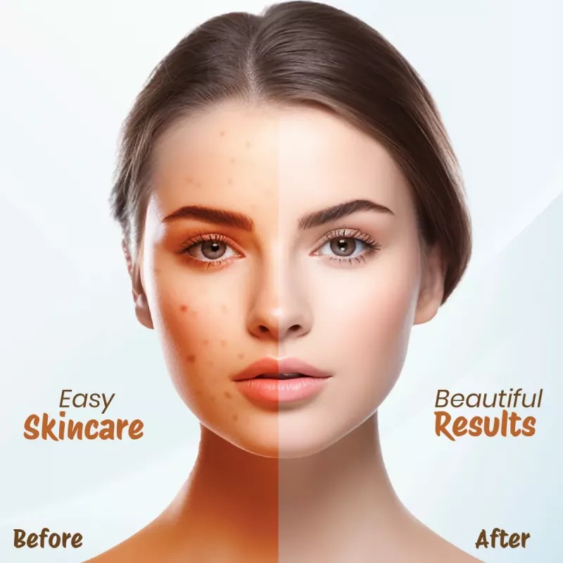 Nisha Multani Mitti Sandal Face Pack Powder (100g)