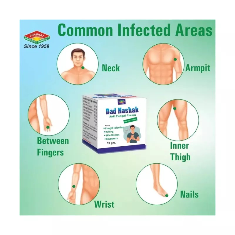 Prabhat Ayurvedic Dad Nashak Anti Fungal Cream (10g)