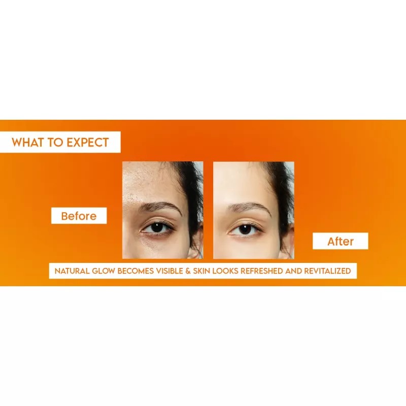 Kaylite Vitamin C Cream (20g)