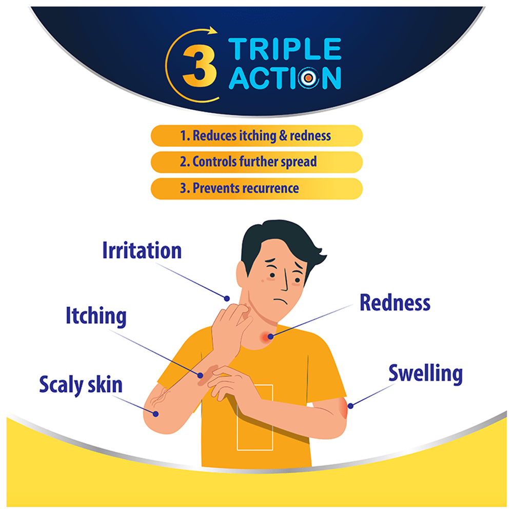 Medisynth Ringoment Anti-Fungal Cream tube of 20 gm Cream